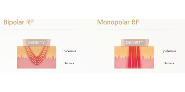 Dual-Action RF Technology: Instant & Lasting Results